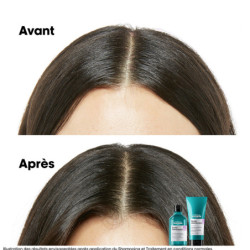 Shampoing dermo-régulateur apaisant Scalp Advanced