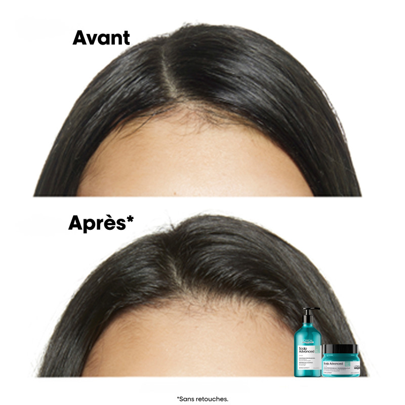 Shampoing dermo-purifiant pour cuirs chevelus gras Scalp