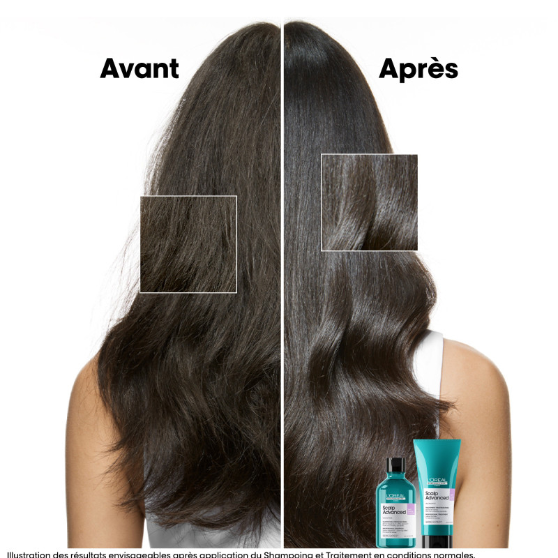 Shampoing dermo-régulateur apaisant Scalp Advanced