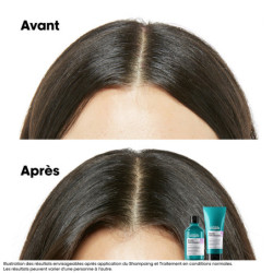 Shampoing dermo-régulateur apaisant Scalp Advanced