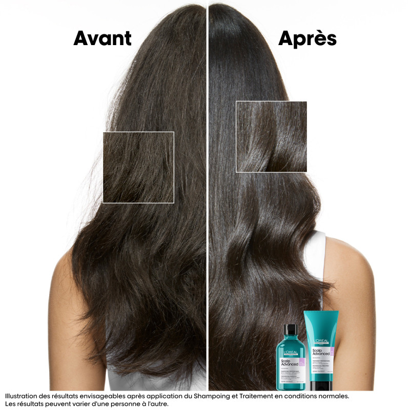 Shampoing dermo-régulateur apaisant Scalp Advanced