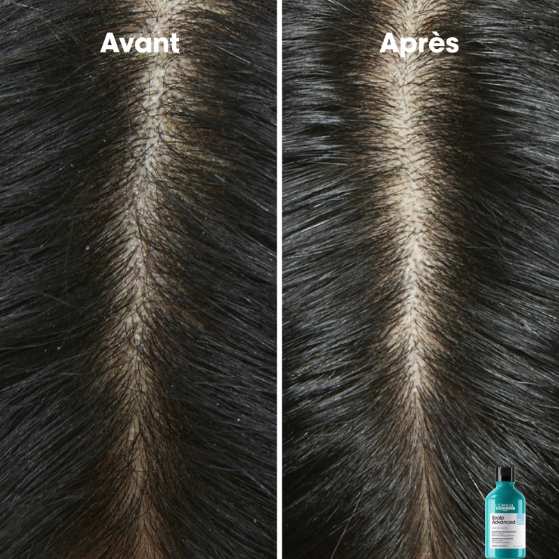 Shampoing dermo-purifiant pour cuirs chevelus gras Scalp