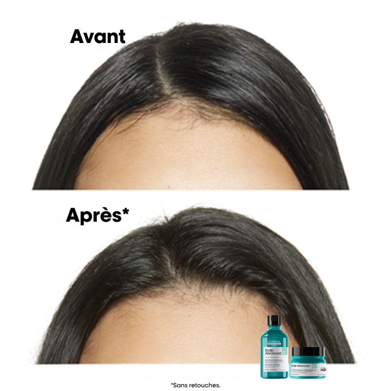 Shampoing dermo-purifiant pour cuirs chevelus gras Scalp