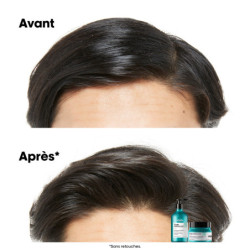 Shampoing dermo-purifiant pour cuirs chevelus gras Scalp