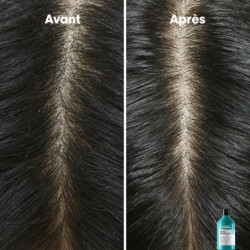 Shampoing dermo-clarifiant anti-pelliculaire Scalp Advanced
