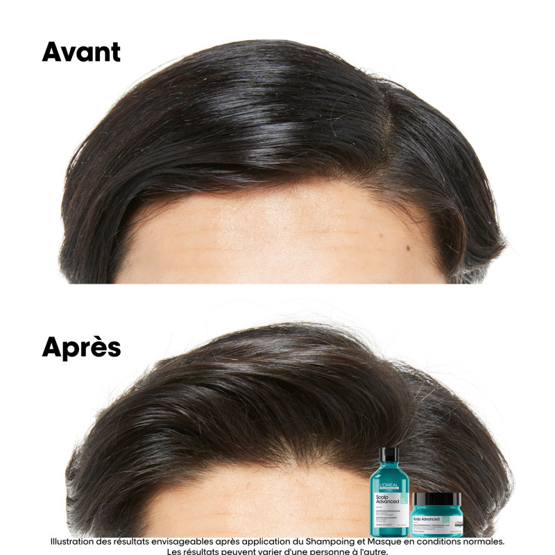 Shampoing dermo-purifiant pour cuirs chevelus gras Scalp