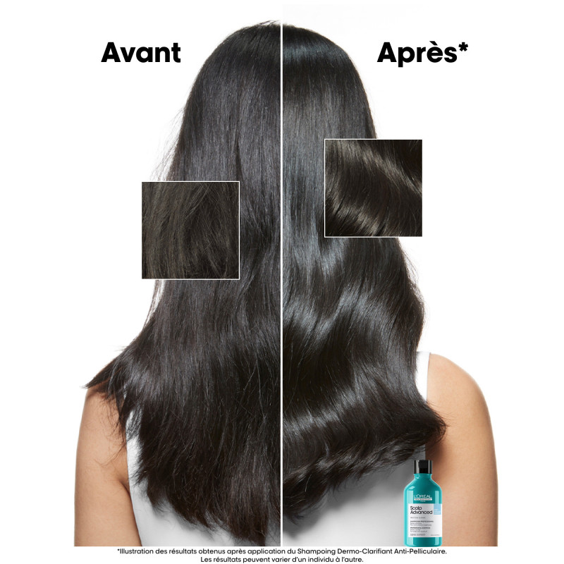 Shampoing dermo-clarifiant anti-pelliculaire Scalp Advanced