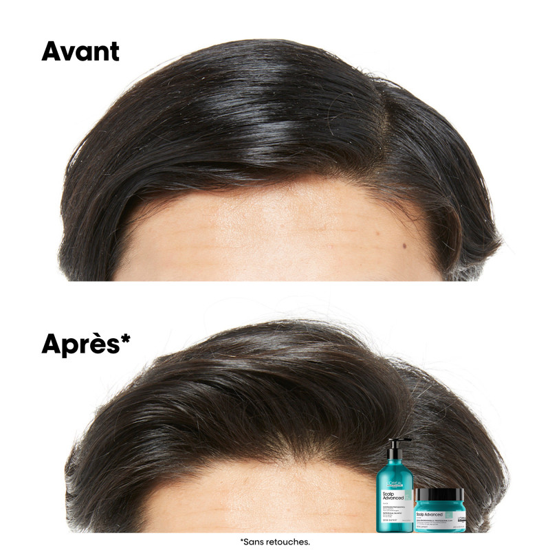 Shampoing dermo-purifiant pour cuirs chevelus gras Scalp
