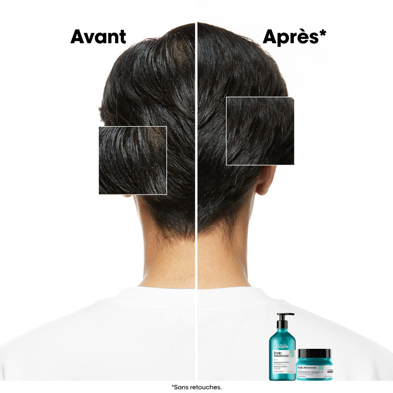 Shampoing dermo-purifiant pour cuirs chevelus gras Scalp